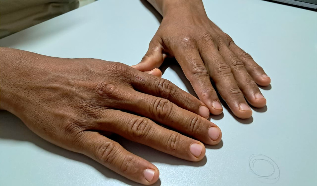 Foto: Divulgação PMM